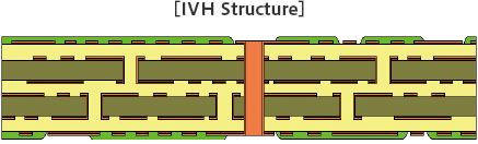Figure: IVH Structure